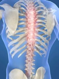torasik osteokondroz durumunda spinal lezyon