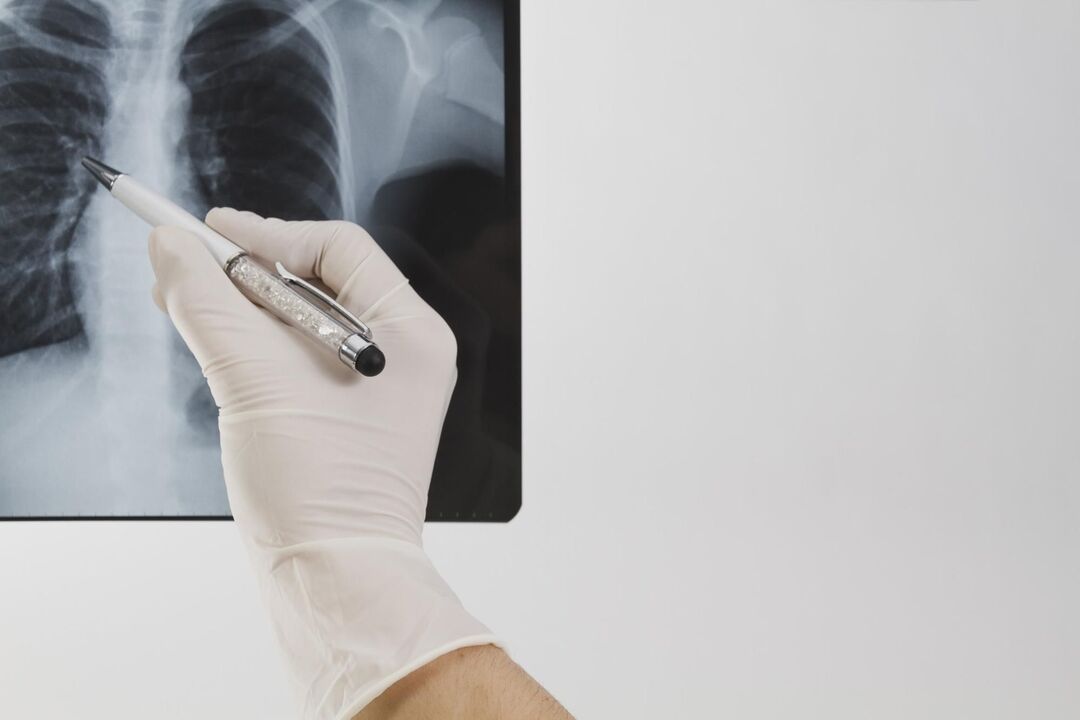 Osteokondroz teşhisi için röntgen
