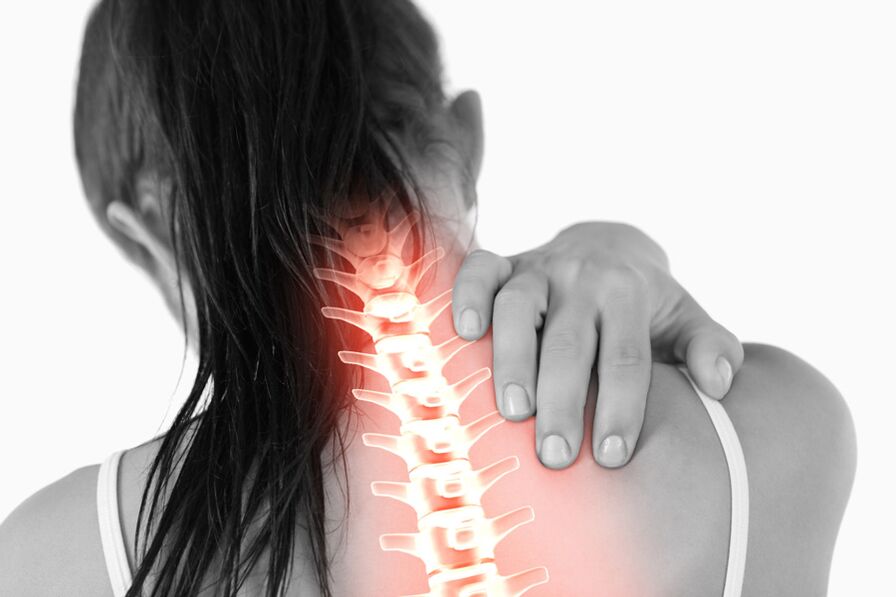 Kadınlarda torasik omurganın osteokondrozu nedeniyle ağrı boyun bölgesine yayılabilir