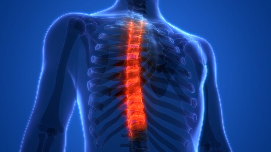 Torasik omurganın osteokondrozu, intervertebral disklerin tahrip edilmesiyle karakterize edilir