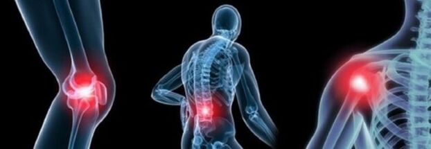 Arthroz ile ağrı türleri