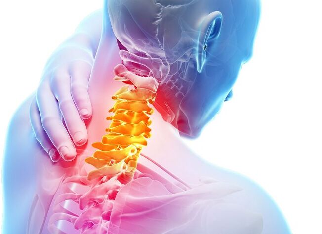 Servikal osteokondroz gelişiminin semptomları ve aşamaları