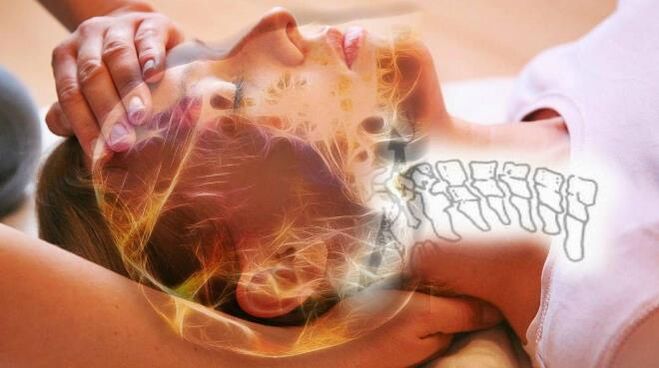 Servikal osteokondroz için vertebral disklerde dejeneratif değişiklikler