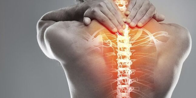 Servikal osteokondrozun servikal tedavisi için tıbbi seçenekler